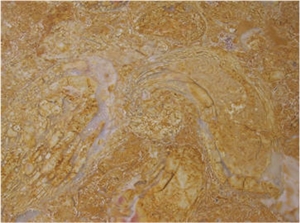 Amarelo De Negrais Limestone Amarelo De Negrais Limestone
