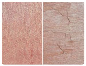 Lime Pink Limestone Slabs & Tiles, India Pink Limestone