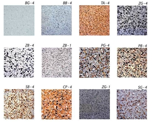 Terrazzo,quartz Stone Tile Terrazzo,quartz Stone Tile