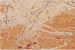 BILECIK PINK marble tiles & slabs, polished marble floor covering tiles, walling tiles 