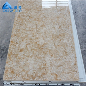 High-Grade Pattern Artificial Stone