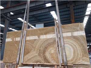 Oran Onyx for Wall and Floor Tile