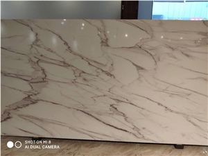 High-Temperature 3d Inkjet (Never Fade) Quartz Stone Slabs