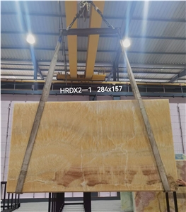 China Resin Yellow Songxiang Onyx Slab In China Stone Market